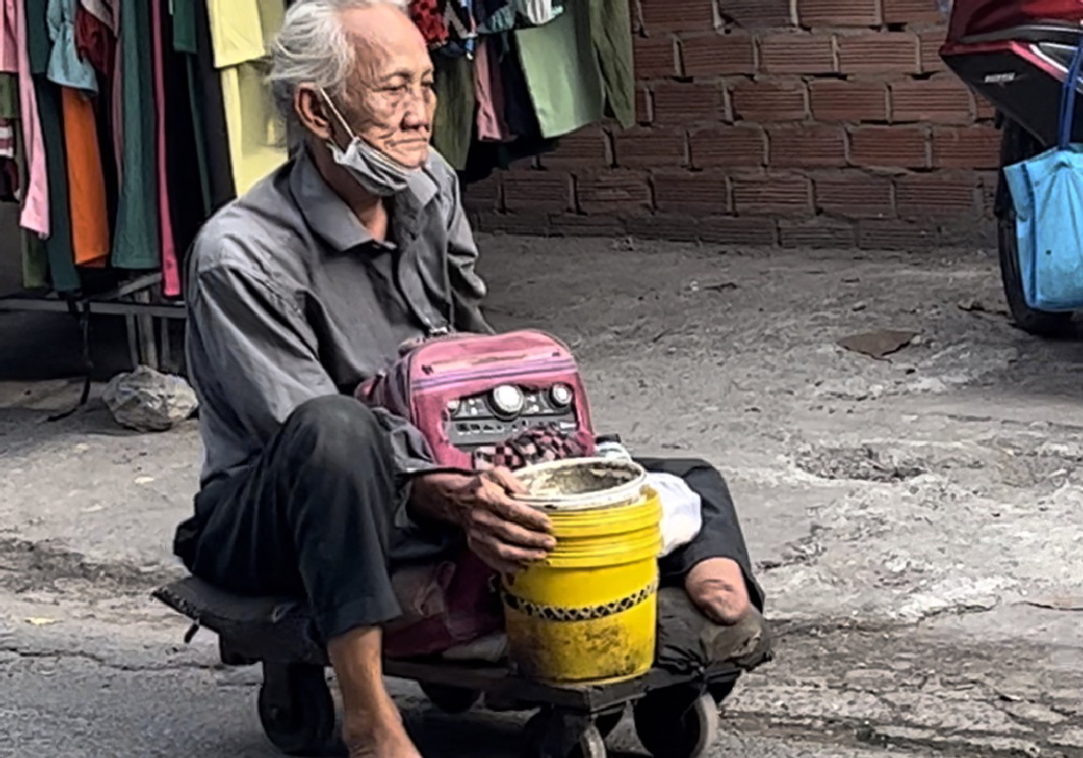 Kêu Gọi Giúp Chú Mỹ Cụt Chân