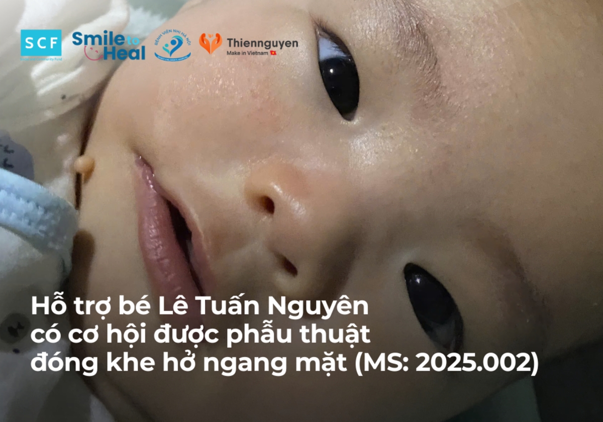10 ngày để Hỗ trợ bé Lê Tuấn Nguyên có cơ hội được phẫu thuật đóng khe hở ngang mặt (MS: 2025.002)